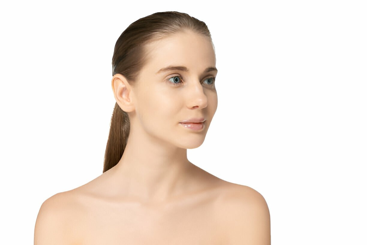 Minifacelift