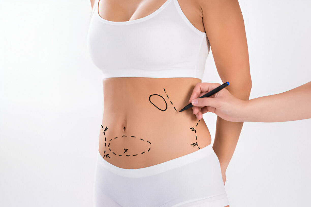 tummy