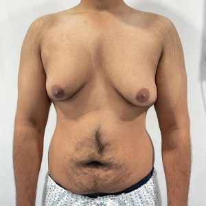 gyne