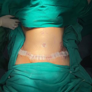 Body Conturing