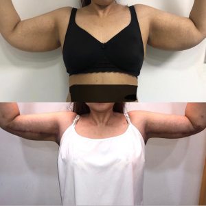 Body Conturing