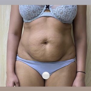 Body Conturing