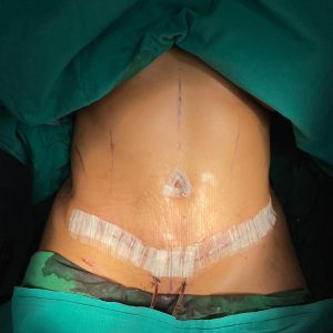 BodyConturing