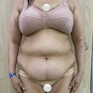 BodyConturing