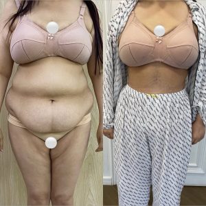 Body Conturing