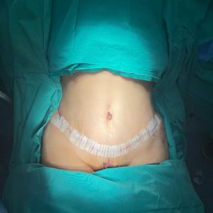 Body Conturing